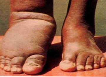 सीमावर्ती क्षेत्रका गाँउ हात्तीपाइलेको उच्च जोखिममा